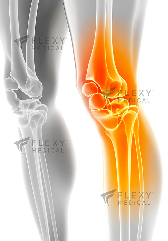 FlexyTherm™ Termal Siyah Yün Dizlik Sıcak Tutan Diz Koruyucu Esnek Kaymaz Diz Destekleyici Günlük Kullanım Soğuk Hava İçin Konforlu Unisex Diz Bandı Romatizma Ağrı Destek Dizliği İçlik Kullanımına Uygun